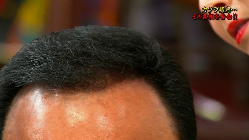 f:id:onodan:20171231112932j:plain