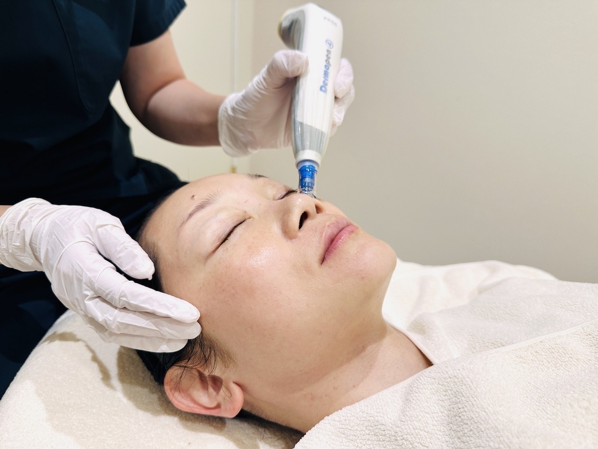 ダーマペン 痛くないダーマペン×マッサージピール！毛穴の引き締め＆なめらか肌を