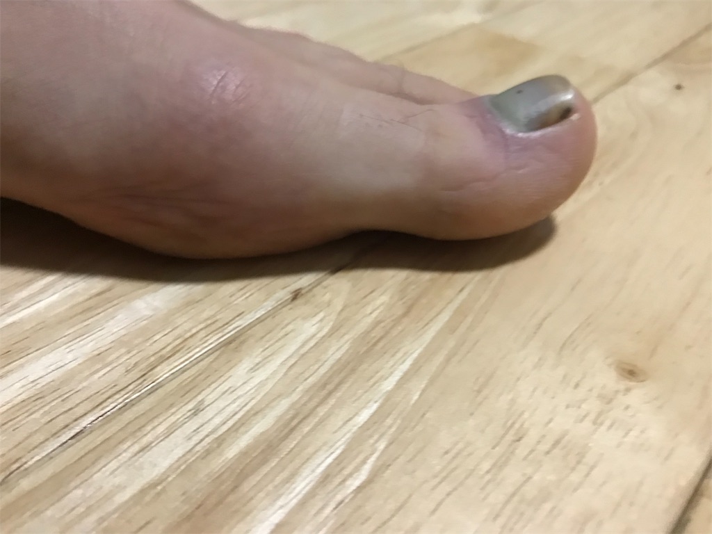 f:id:oooka-ryo:20190224224814j:image f:id:oooka-ryo:20190224224814j:image