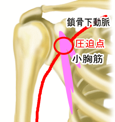 過外転症候群