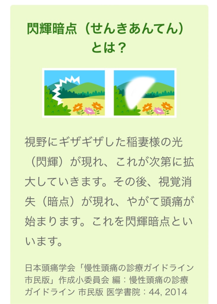 頭痛の前兆 閃輝暗点とは 嘔吐 吐き気にも生姜が効く Oowater3の日記 頭痛の前兆 閃輝暗点とは 嘔吐 吐き気にも生姜が効く Oowater3の日記