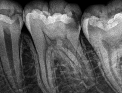 f:id:orangedental:20170824230402j:plain f:id:orangedental:20170824230402j:plain