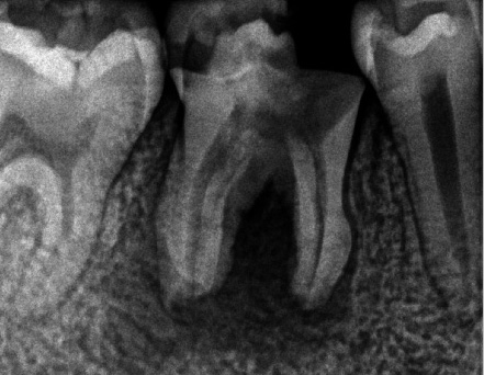 f:id:orangedental:20170824230407j:plain f:id:orangedental:20170824230407j:plain