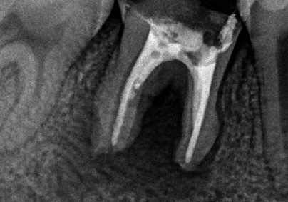 f:id:orangedental:20170824230425j:plain f:id:orangedental:20170824230425j:plain