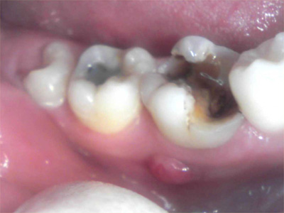 f:id:orangedental:20170824230435j:plain f:id:orangedental:20170824230435j:plain