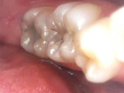 f:id:orangedental:20170824230621j:plain f:id:orangedental:20170824230621j:plain