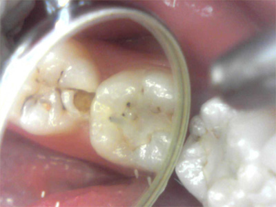 f:id:orangedental:20170824230628j:plain f:id:orangedental:20170824230628j:plain