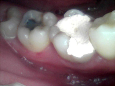f:id:orangedental:20170824230635j:plain f:id:orangedental:20170824230635j:plain