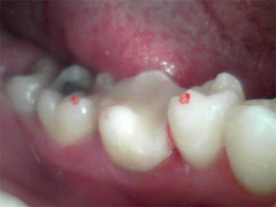f:id:orangedental:20170824230643j:plain f:id:orangedental:20170824230643j:plain