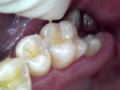 f:id:orangedental:20171013011722j:plain f:id:orangedental:20171013011722j:plain