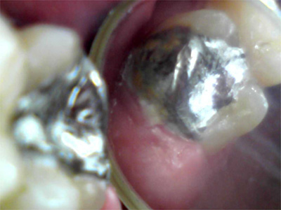 f:id:orangedental:20171013011729j:plain f:id:orangedental:20171013011729j:plain