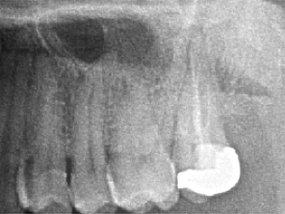 f:id:orangedental:20171013011742j:plain f:id:orangedental:20171013011742j:plain