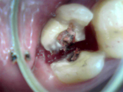 f:id:orangedental:20171013011748j:plain f:id:orangedental:20171013011748j:plain