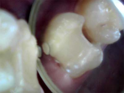 f:id:orangedental:20171013011812j:plain f:id:orangedental:20171013011812j:plain