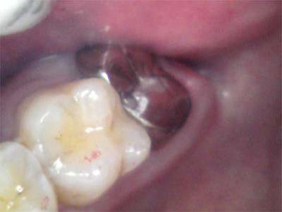 f:id:orangedental:20171013011822j:plain f:id:orangedental:20171013011822j:plain