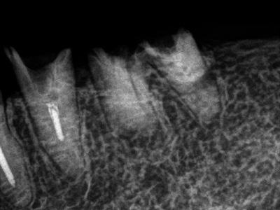 f:id:orangedental:20180310222627j:plain f:id:orangedental:20180310222627j:plain