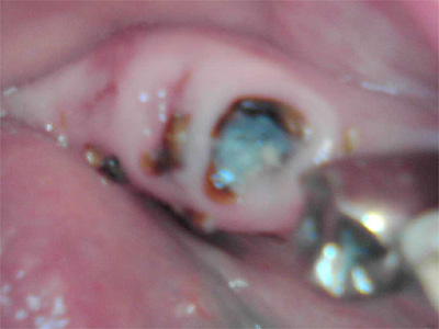 f:id:orangedental:20180310222633j:plain f:id:orangedental:20180310222633j:plain