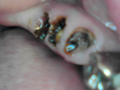 f:id:orangedental:20180310222639j:plain f:id:orangedental:20180310222639j:plain