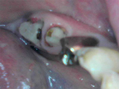 f:id:orangedental:20180310222645j:plain f:id:orangedental:20180310222645j:plain