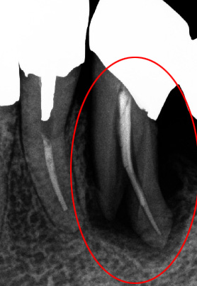 f:id:orangedental:20180310222710j:plain f:id:orangedental:20180310222710j:plain