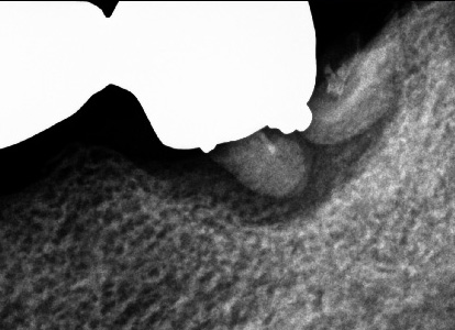 f:id:orangedental:20180310222717j:plain f:id:orangedental:20180310222717j:plain