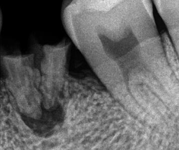 f:id:orangedental:20180310222724j:plain f:id:orangedental:20180310222724j:plain