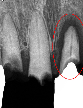 f:id:orangedental:20180310222731j:plain f:id:orangedental:20180310222731j:plain