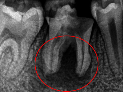 f:id:orangedental:20180310222738j:plain f:id:orangedental:20180310222738j:plain