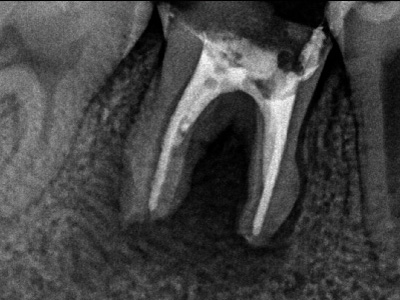 f:id:orangedental:20180310222744j:plain f:id:orangedental:20180310222744j:plain