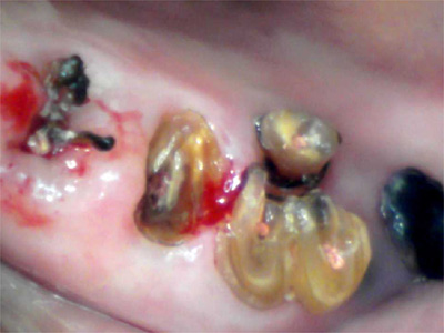 f:id:orangedental:20180310230625j:plain f:id:orangedental:20180310230625j:plain