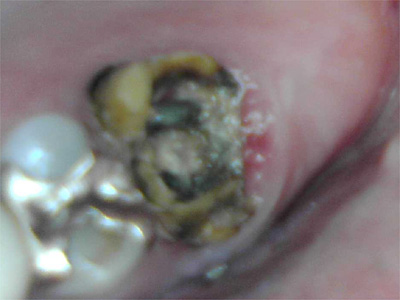 f:id:orangedental:20180310235102j:plain f:id:orangedental:20180310235102j:plain