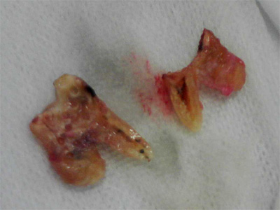 f:id:orangedental:20180310235109j:plain f:id:orangedental:20180310235109j:plain