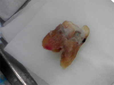 f:id:orangedental:20180310235114j:plain f:id:orangedental:20180310235114j:plain