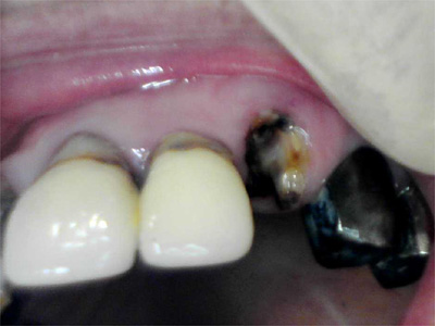 f:id:orangedental:20180310235232j:plain f:id:orangedental:20180310235232j:plain