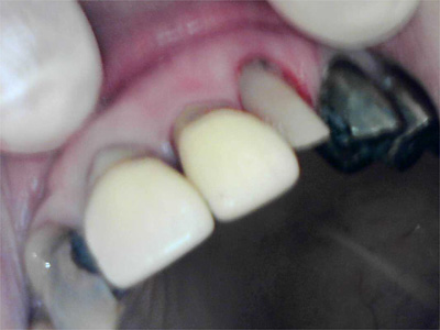 f:id:orangedental:20180310235309j:plain f:id:orangedental:20180310235309j:plain