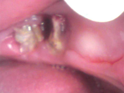 f:id:orangedental:20180310235441j:plain f:id:orangedental:20180310235441j:plain