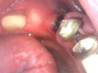 f:id:orangedental:20180310235446j:plain f:id:orangedental:20180310235446j:plain