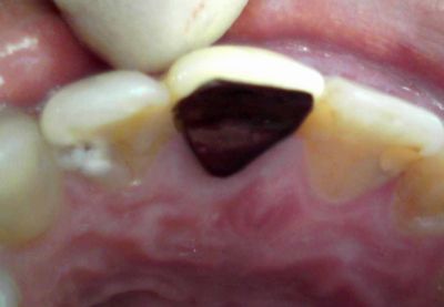 f:id:orangedental:20220210200320j:plain