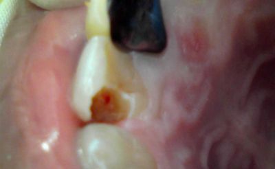 f:id:orangedental:20220210200420j:plain