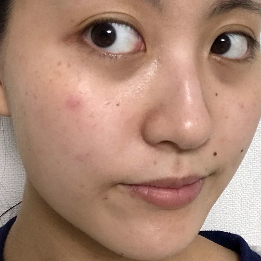 私のきれい日記 アロエマスク 使用前後