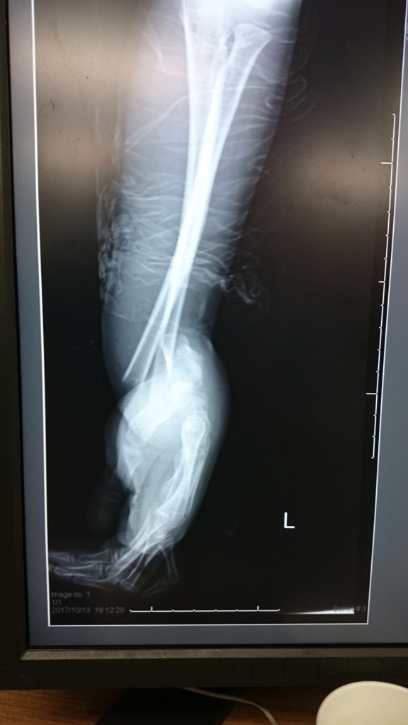 f:id:orthopaedicrheumatologist:20171014151347j:plain f:id:orthopaedicrheumatologist:20171014151347j:plain