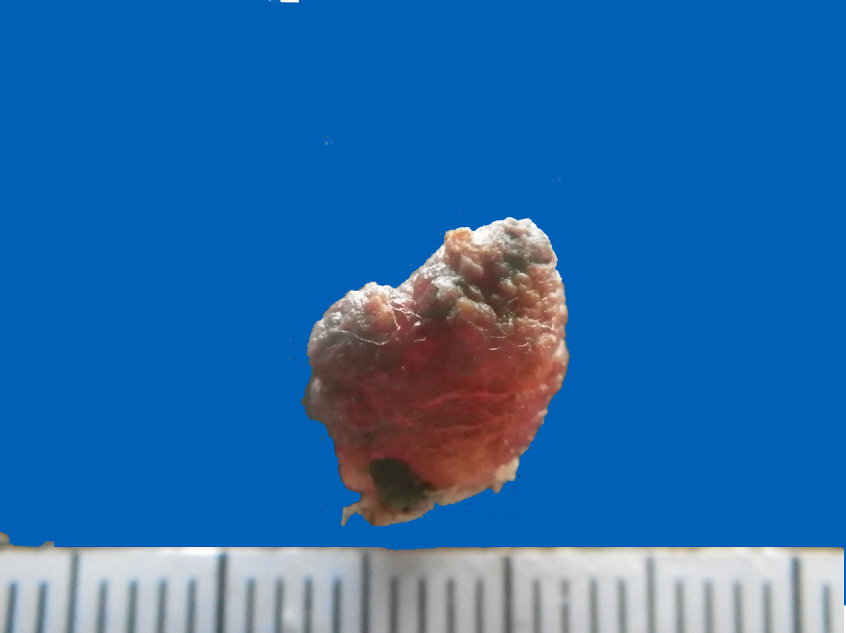 f:id:osakawan:20190815145556j:plain f:id:osakawan:20190815145556j:plain
