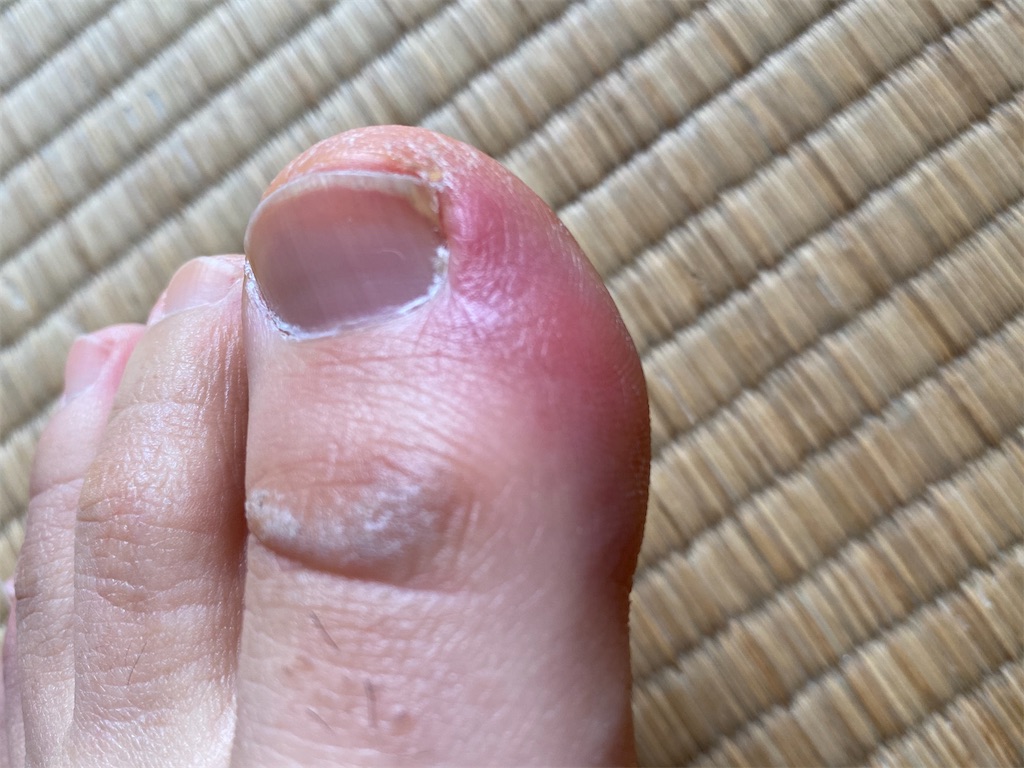 f:id:osamu-3:20200224144132j:image f:id:osamu-3:20200224144132j:image