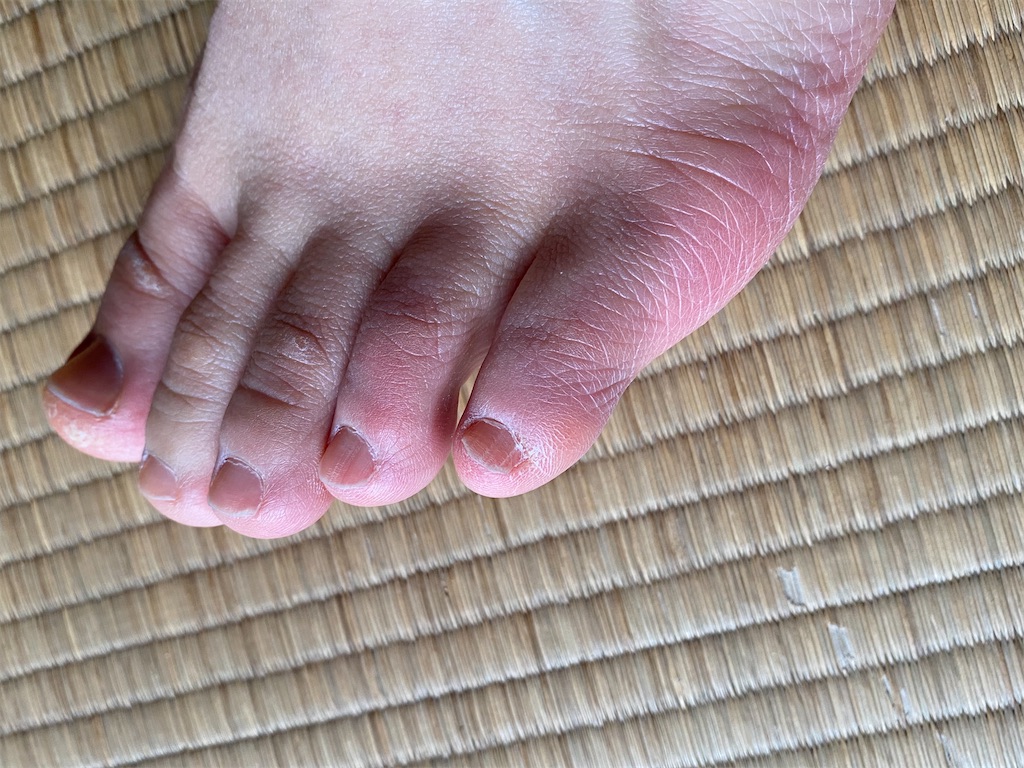 f:id:osamu-3:20200224144141j:image f:id:osamu-3:20200224144141j:image