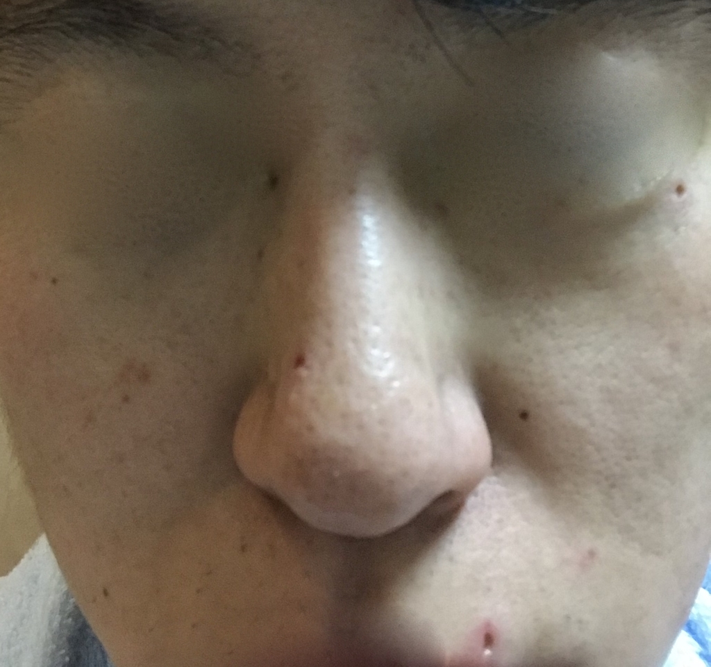 f:id:osozaki7:20190211180437j:plain f:id:osozaki7:20190211180437j:plain