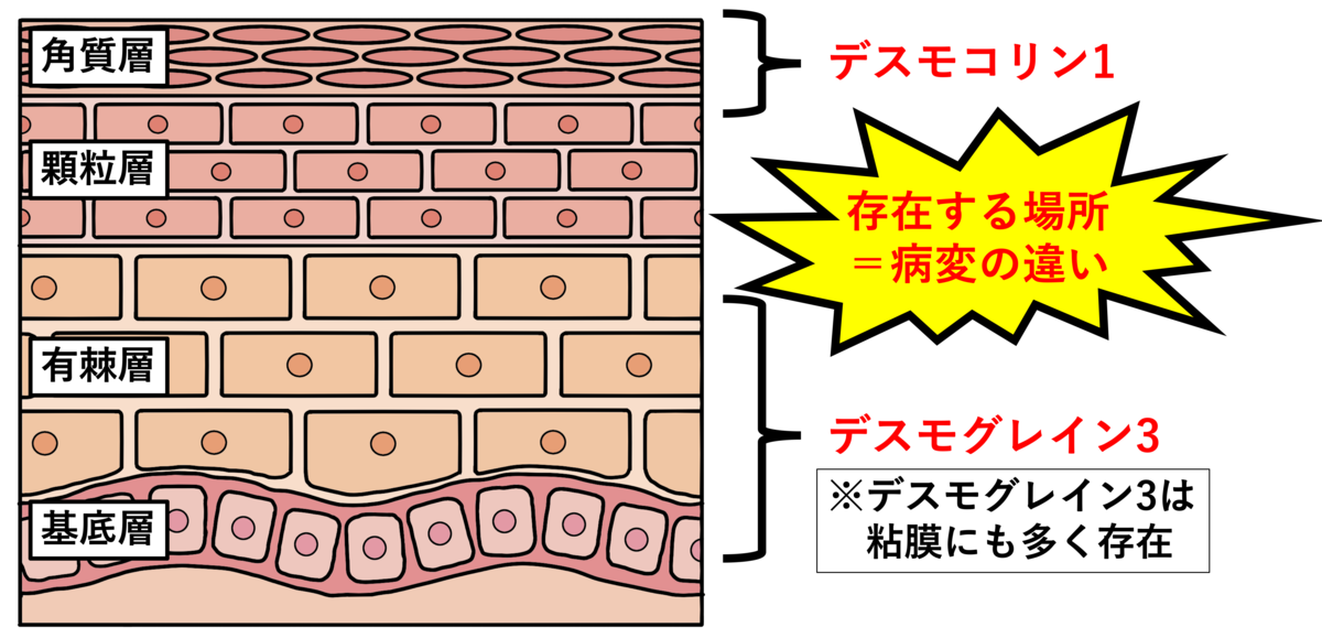 天疱瘡は表皮細胞間抗体ですか？ _ 天疱瘡 多い年齢 – VTTNVT