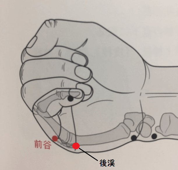 必見 首の寝違えを早く治すための３つの方法を紹介 一人鍼灸整骨院のまったり開業 運営記