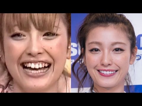 最新のhd歯並び 悪い 女 可愛い 最高の動物画像 最新のhd歯並び 悪い 女 可愛い 最高の動物画像