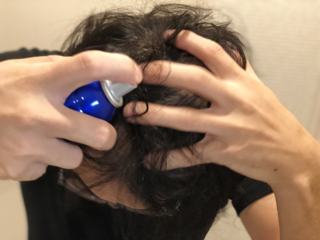 育毛剤の成分