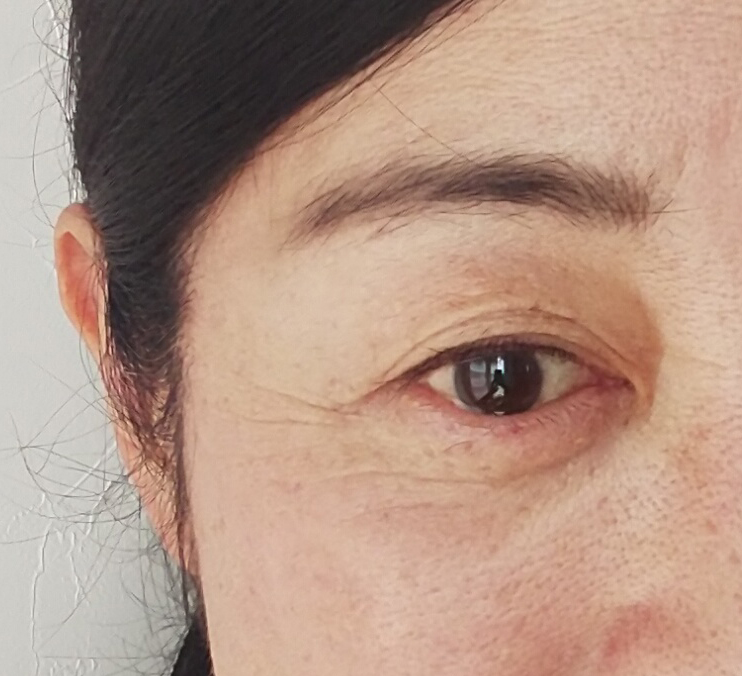 薄くなった目尻のシワ